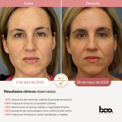 BaoCosmetics® Máscara LED Facial para Piel Terapia Luz Infrarroja