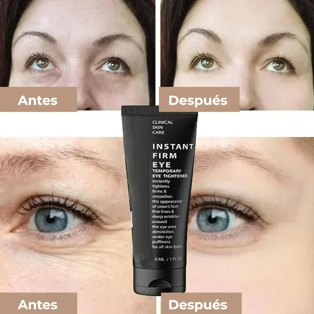 CREMA REJUVENECEDORA CELYN 🌟 (30 ml) ¡ORIGINAL USA MISMA PRESENTACIÓN! 🌸💖