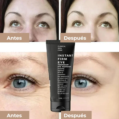 CREMA REJUVENECEDORA CELYN 🌟 (30 ml) ¡ORIGINAL USA MISMA PRESENTACIÓN! 🌸💖