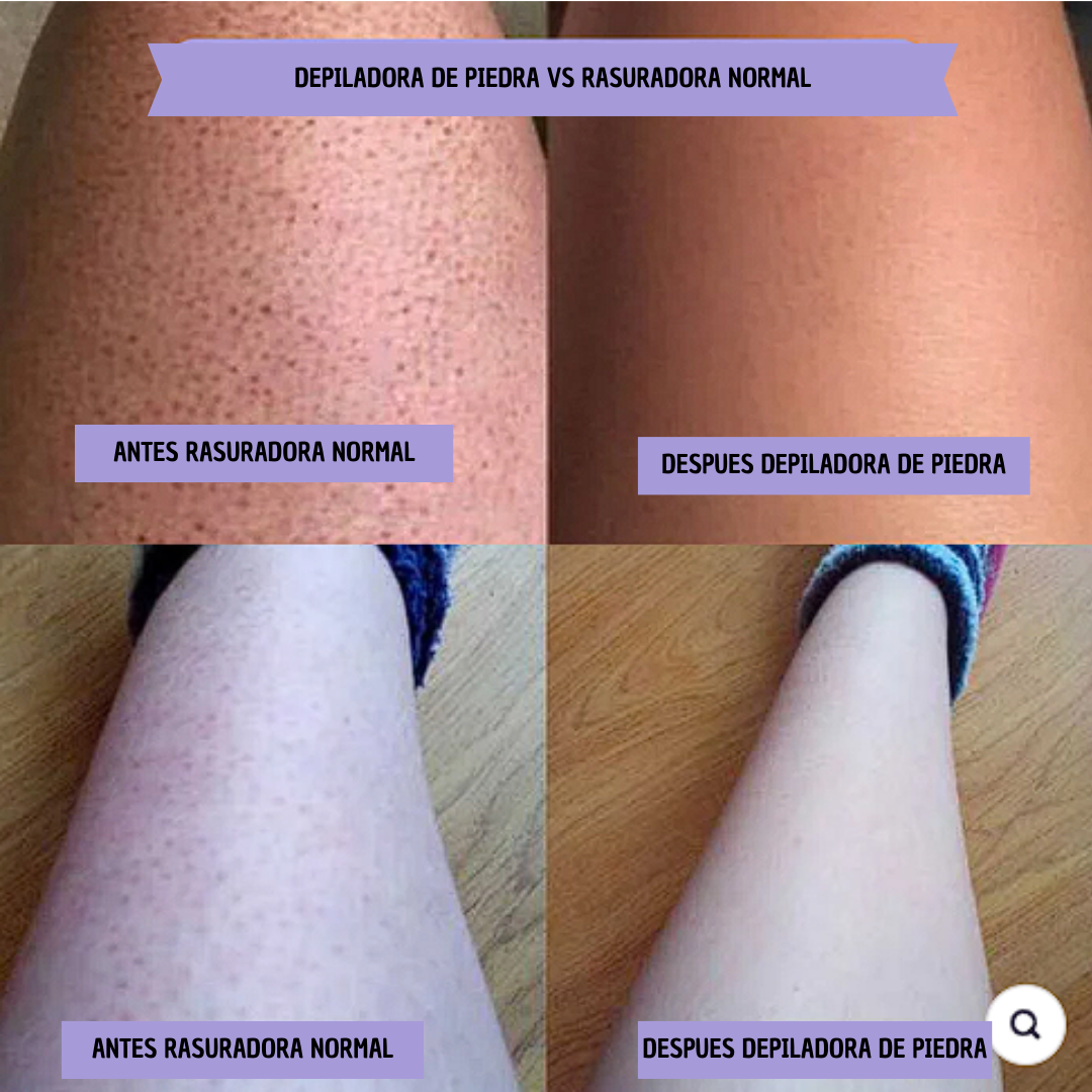 Depilador de Cristal Mágico de Bao Cosmetic™