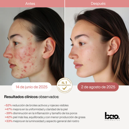 BaoCosmetics® Máscara LED Facial para Piel Terapia Luz Infrarroja