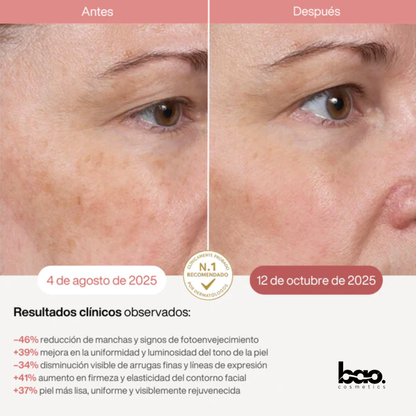 BaoCosmetics® Máscara LED Facial para Piel Terapia Luz Infrarroja